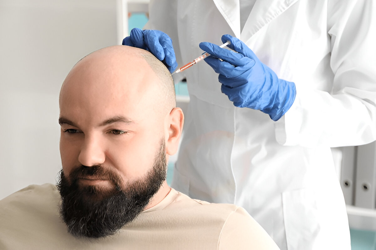 best hair transplant UK