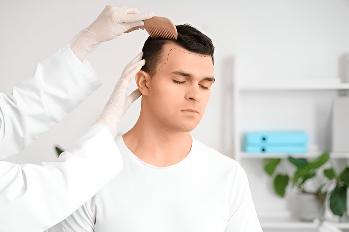 Hair Transplant