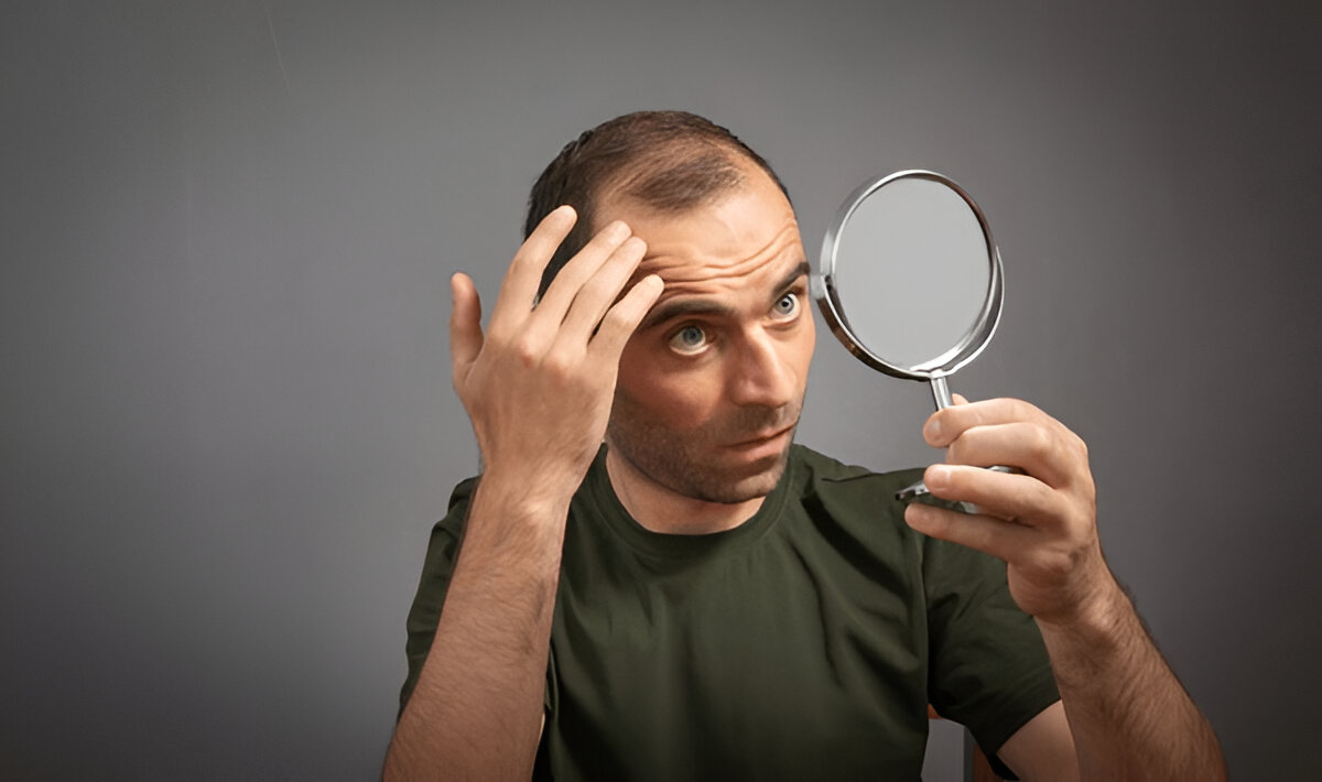 hair Transplant London